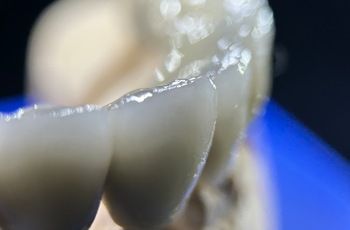  Cirkon-kerámia close-up
